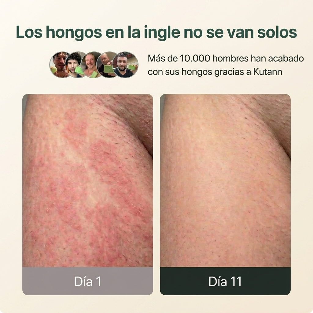 Kutann® — Jabón Antifúngico de Árbol de Té | Piel sana en 14 días